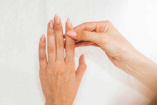 Методы лечения отслоения ногтей на руках