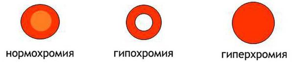 Классификация анемий согласно цветовому показателю