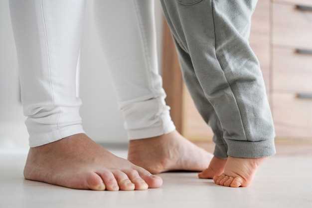 Методы лечения шипички на ноге у ребенка