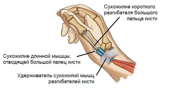 Удерживатель разгибателей