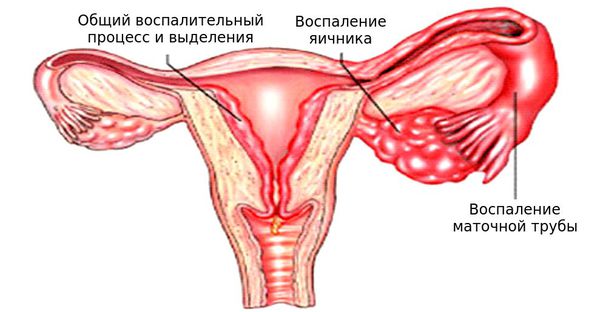 Какие препараты от шума в голове и ушах самые лучшие